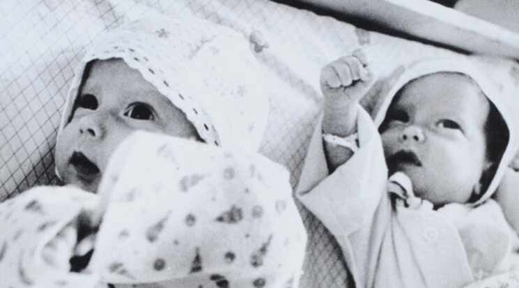 Вот как сейчас живут и выглядят сиамские близняшки, которые родились с одним животом на двоих