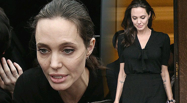 Из-за стресса после развода у Анджелины Джоли развился лицевой паралич