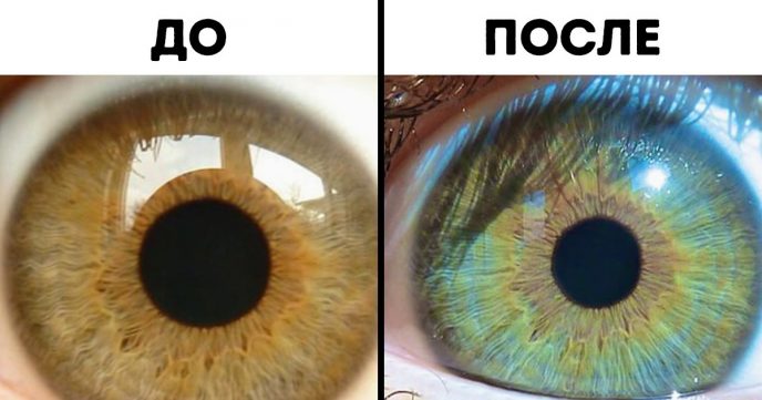 3 причины, которые могут изменить цвет ваших глаз